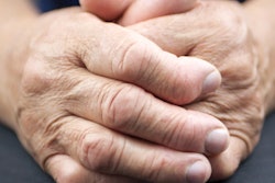 2020 05 22 20 15 1828 Hands Arthritis Rheumatoid 400