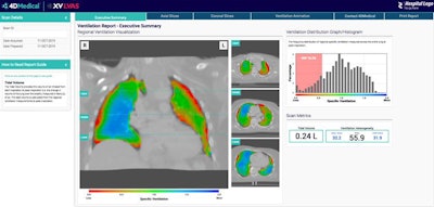 XV Technology quantifies functional lung impairment on fluoroscopy exams and provides ventilation reports. Image courtesy of 4DMedical.