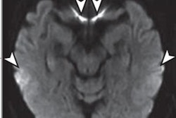 2020 05 29 22 13 0666 2020 06 01 Bizzi Mri 20200529225519
