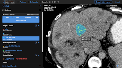 AI Metrics' AI software measures tumors, labels their anatomic location, calculates treatment response, and produces reports that include a graph, table, and key images. Image courtesy of Dr. Andrew Smith, PhD.