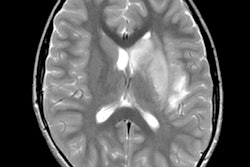 2020 06 02 21 37 5222 2020 06 03 Pediatric Stroke Covid Figure1 A