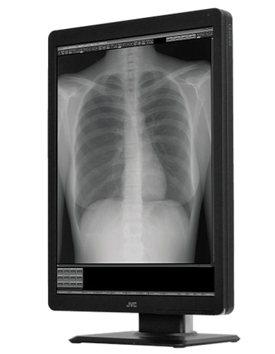 Hidemortexディスプレイ Amazon.com: Qiape Monitor Display Panel 4454519 4483034