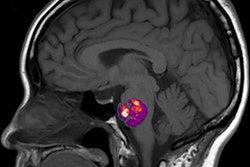 2020 06 03 22 39 8007 2020 06 03 Mri Gut Biome 20200603220158