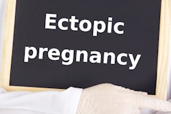 2020 06 05 20 02 0258 Ectopic Pregnancy 400