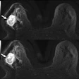 2020 06 06 00 13 6851 2020 06 08 Muse Dwi Mri 2