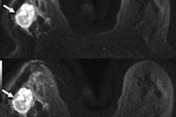 2020 06 06 00 13 6851 2020 06 08 Muse Dwi Mri 2