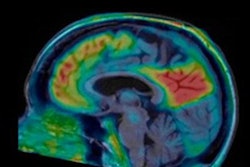 2020 06 08 20 16 5036 2020 06 08 Pi 2620 Pet Alzheimers Mol Insider 20200608205716