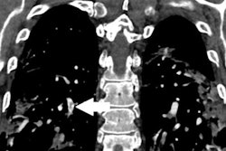 2020 06 09 21 32 5415 2020 06 12 Ctpa Figure 2c 20200609213510