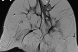 2020 06 12 17 13 1362 2020 06 15 Kaiser Score Figure 5 20200612170027