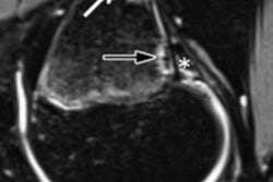 2020 06 13 00 30 6352 2020 06 16 Mri Alpine Ski Figure 4 20200613001512