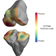 2020 06 15 16 42 2280 2020 06 09 Mri Bone 20200615170158