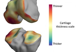 2020 06 15 16 42 2280 2020 06 09 Mri Bone 20200615170158