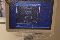 2020 06 15 20 28 2578 2020 06 17 Ajr Ultrasound Bag 20200615204327