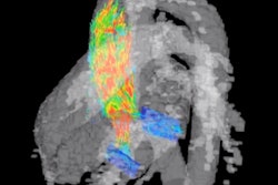 2020 06 19 18 43 8382 2020 06 19 4 D Flow Mri