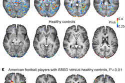 2020 06 19 22 46 6574 2020 06 19 Dce Mri 20200619222901 20200619223304