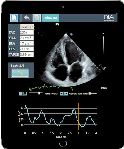DiA's new AI-based ultrasound analysis tool LVivo RV. Image courtesy of DiA.