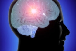2020 06 25 03 24 9659 Head Brain Thinking 400