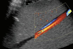 2020 06 29 22 44 0364 2020 06 30 3 D Ultrasound Flow Thumb