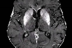 2020 06 29 23 02 2921 2020 06 30 Radiology Schmidt Mri 20200629233445