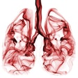 2017 02 01 16 41 06 305 Lungs Smoke 400