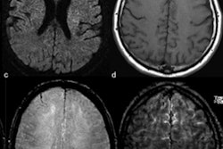 2020 05 13 20 53 8134 2020 05 14 Brain Mri Covid Figure 2 400
