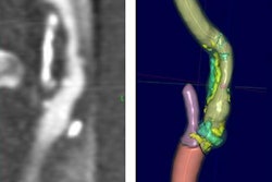 2020 07 01 19 04 1097 2020 07 01 Elucid Bio 20200701191918 20200701192116