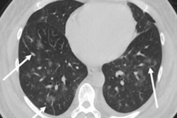 2020 07 07 21 23 9654 2020 07 08 Covid Abdominal Symptoms Figure2 20200707213507