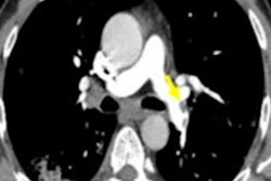 2020 07 09 20 49 4446 2020 07 10 Pte Covid Figure3 20200709205141