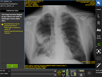 A demonstration of Critical Care Suite. Image courtesy of University Hospitals.