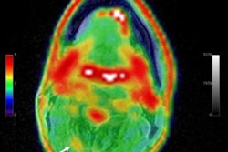 2020 07 14 17 31 5604 2020 07 13 Snmmi Pet Ct Chronic 20200714171440