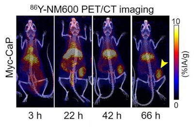 PET/CT image shows uptake and retention of 86Y-NM600 (imaging agent) in immunocompetent mice bearing prostate tumors. PET imaging data was employed to estimate tumor dosimetry and prescribe an immunomodulatory 90Y-NM600 dose as a therapy agent. Image courtesy of Reinier Hernandez, PhD, et al, University of Wisconsin-Madison.