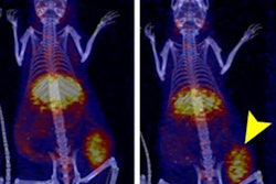 2020 07 14 17 49 4486 2020 07 14 Radionuclide Therapy 20200714174027
