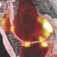 2020 07 14 20 06 2345 2020 07 13 Snmmi Bone Imaging 20200714204612