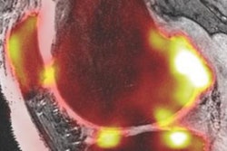 2020 07 14 20 06 2345 2020 07 13 Snmmi Bone Imaging 20200714204612