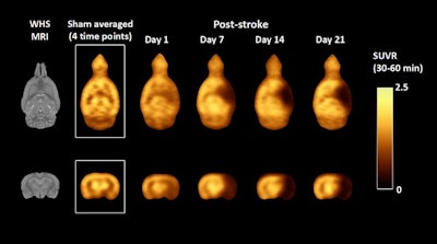 Average SUV ratio PET images of stroke rat model over time as compared with a sham rat using mean cerebellum as the reference. Image courtesy of T. Toyonaga and X. Lyu, Yale University, New Haven CT.