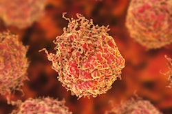 2020 07 15 23 29 3710 Cancer Cells Prostate 400