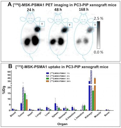 Image A shows PET images (coronal slices) of 124I-MSK-PSMA1 in mice bearing prostate cancer cell xenografts on the right shoulder. Image B shows ex vivo biodistribution data of 131I-MSK-PSMA1 in mice bearing prostate cancer cell xenografts. Image courtesy of Kalidindi TM, et al., Pillarsetty Lab, MSKCC, New York, NY.