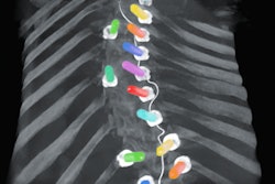 2020 07 16 19 29 6922 2020 07 16 Ziehm Clarity