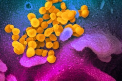 2020 07 21 23 28 6620 Sars Co V 2 Sem 400