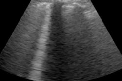 2020 07 22 17 02 8473 2020 07 23 Ct Us Comparison 3 20200722173907