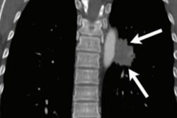 2020 07 22 21 41 8565 2020 07 23 Chest Xray Ai Figure5 20200722211341
