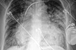 2020 07 23 04 00 3224 2020 07 23 Ai Covid 20200723045759