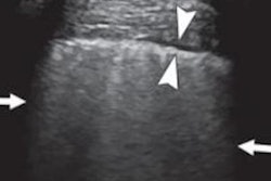 2020 07 24 22 55 4069 2020 07 27 Us Covid Findings 20200724223726