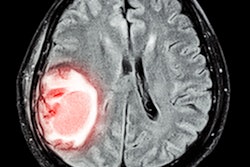 2020 07 28 00 55 7357 Ct Brain Stroke2 400