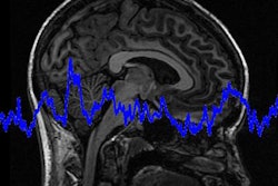 2018 08 15 16 13 8766 Brain Waves 400 20180815163458