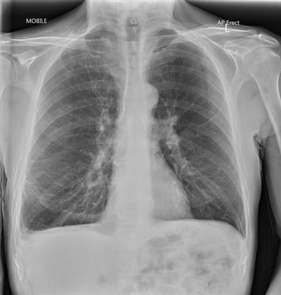An example of how the technique can obtain good image quality (110 kV, 5 mAs). Reproduced with permission of ACPSEM.