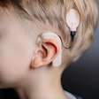 2020 08 05 18 46 6137 Cochlear Implant2 400