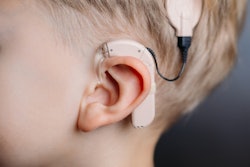 2020 08 05 18 46 6137 Cochlear Implant2 400