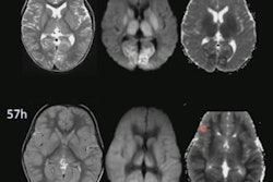 2020 08 09 21 41 8957 2020 08 09 Ismrm Image 3 20200809212549