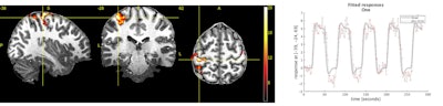 Sample images acquired on Signa 7.0T scanner. Images courtesy of GE Healthcare.